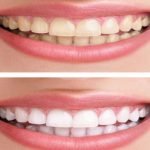 a54aeb01f1337d72a2930a2b56a0fc59