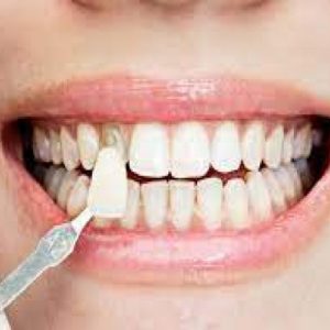 69dc1d2e0505ab8f15c7f4cf343de500