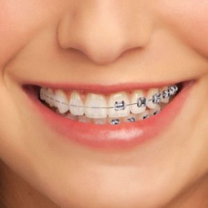 8386dea0c1ad5905e9670c82c2ba973f