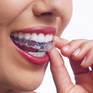 f58e6bc68d211336ac010eb1b5f274fd