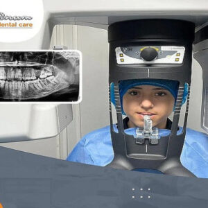 ¡Radiografía Panorámica Dental Digital!