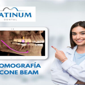 ¡Tomografía dental Cone Beam campo mediano y pequeño! con Platinum Dental