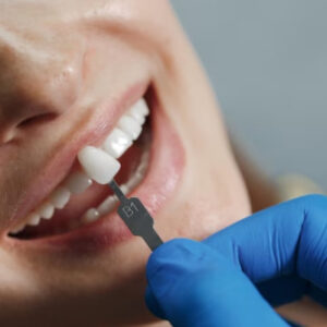 ¡Coronas de zirconio en Armoniza Dent!